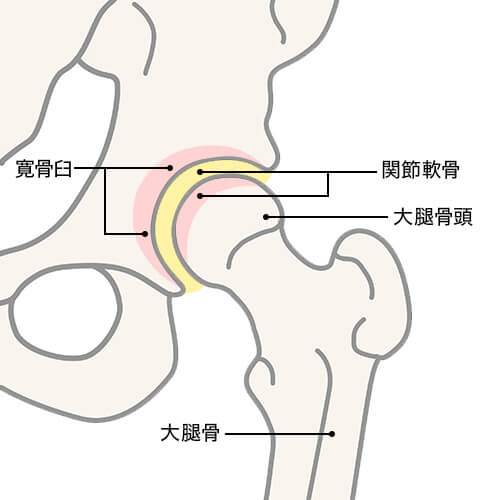 下 腹部 足 の 付け根 痛み