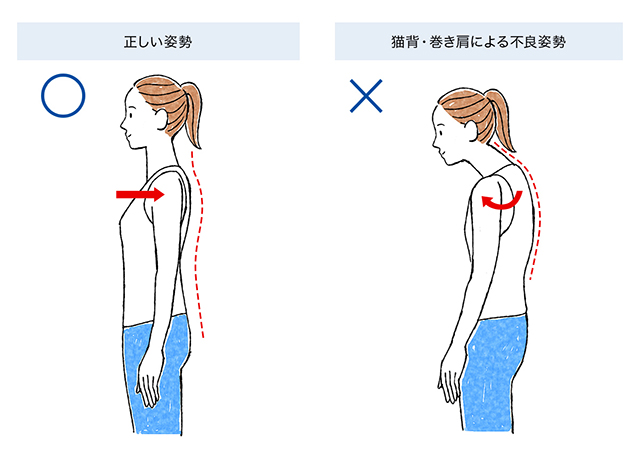 猫背・巻き肩による不良姿勢