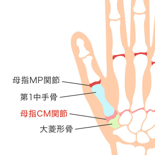 母指CM関節のイラスト