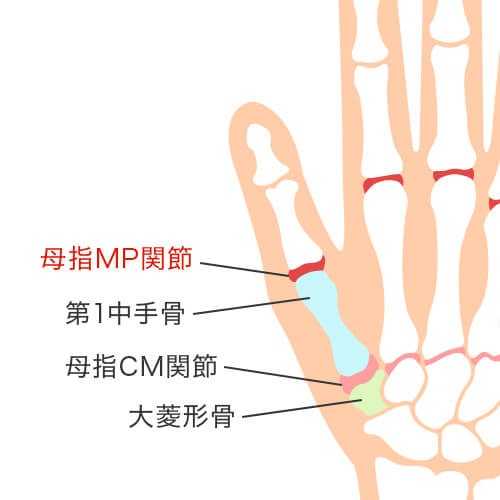 母指MP関節のイラスト