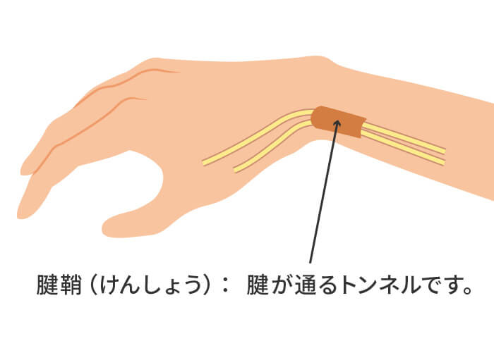 腱鞘のイラスト