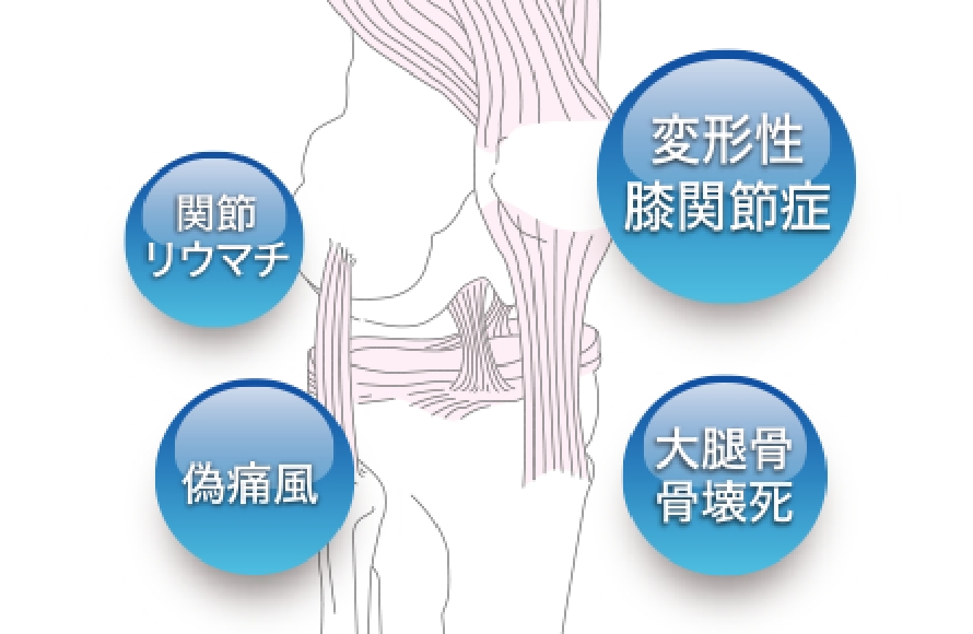 勃起不全薬の写真