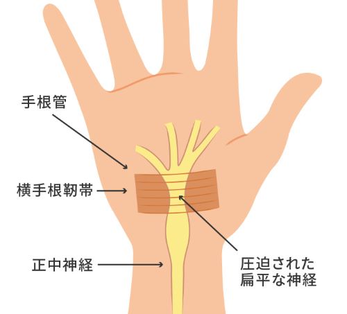 手」の痛み診療室 | MEDIAIDクリニック | MEDIAID Online